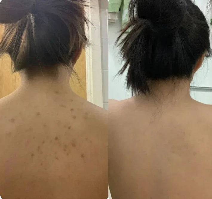 TOALLA EXFOLIANTE ANTIBACTERIANA VELURA
