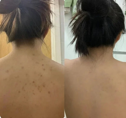 TOALLA EXFOLIANTE ANTIBACTERIANA VELURA